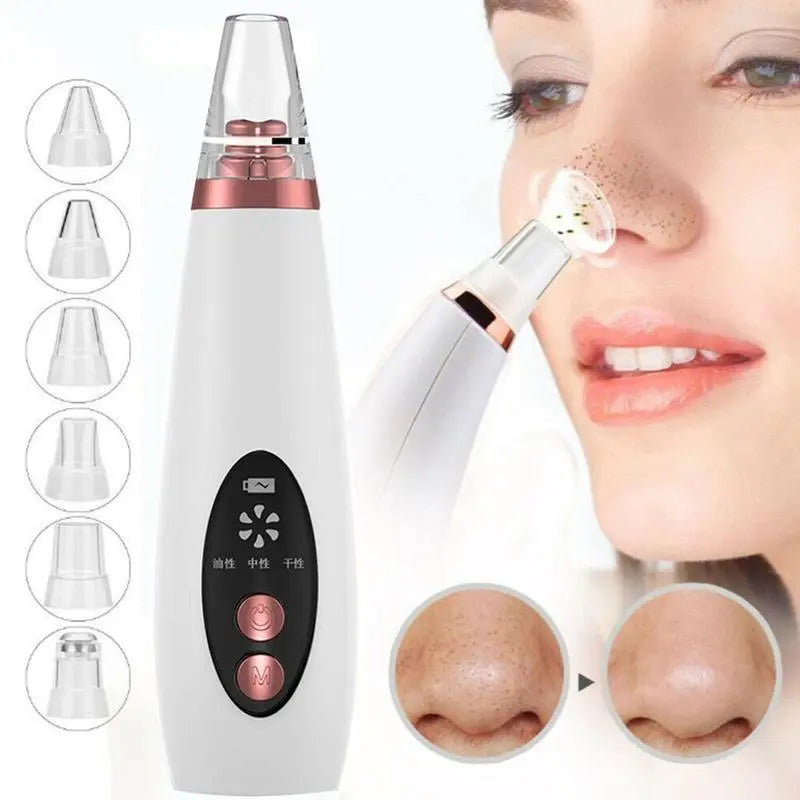 Blackhead Pore Vacuum Cleaner Nose Cleanser Blackheads Remover Blackhead Acne Removal Button Face Suction Beauty Skin Care Tool - Rizk From Razzak